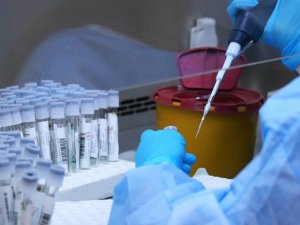 Samsun’da günlük test kapasitesi ise 5 binden 7 bine yükseltildi