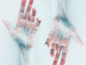 “Zümrüt lazeri ince kılcal damarlı varislerde tedavisinde kullanıyoruz”