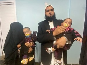 Pakistan’da 9 aylık yapışık ikizler ameliyatla ayrıldı