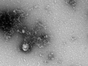 Rusya’da, korona virüs mutasyonunun fotoğrafı çekildi