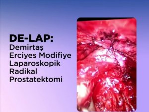 ERÜ’den Prostat Kanseri Tedavisinde Yerli Ve Milli Tedavi Yöntem: DE-LAP