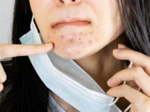 Maske sonrası artan cilt problemlerine önlem de çözüm de su