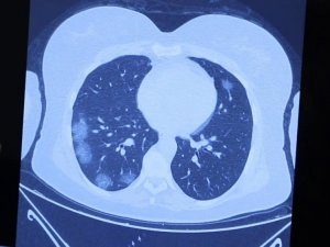 Profesörden korkutan korona açıklaması: "Virüs düşünen bir organizma gibi davranıyor"