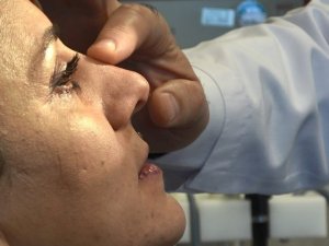 18 yaşından önce estetik olmamak için birçok sebep var