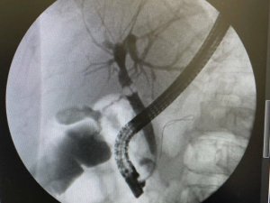 Ağrı’da başarılı operasyon