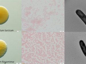 ERÜ’de keşfedilen bakterilere Türk manasına gelen “Turcicum” ve “Kayseriense” ismi verildi