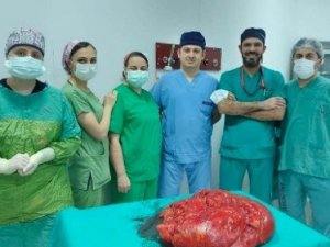 Trabzon’da ameliyata alınan hastanın karnından 21 kiloluk tümör çıkartıldı