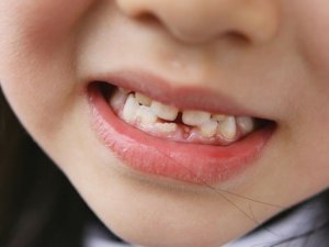 Yer tutucu kullananlar dikkat