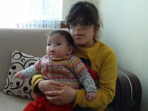 Doğuştan buruları solunum yolları, burunları bulunmayan küçük kız kardeşlerin zorlu hayatı