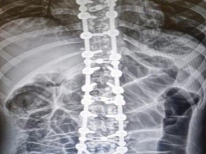 “Osteopati tedavisinde hastalık yoktur, hasta vardır”