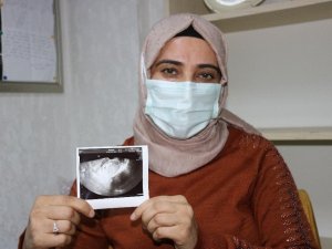 ’Çocuğunuz olmaz’ denilen çift, Rosi yöntemiyle gebelik haberini aldı