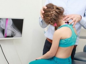 Çocuklarda duruş bozuklukları ve tedavi yöntemleri