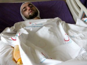 Banyo yapmak için sobaya benzin döktü, feci şekilde yandı