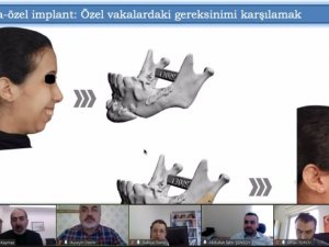 Prof. Dr. Kaymaz: “Hastanelerde ‘hastaya özel’ implant tasarımı ve imalat birimleri kurulmalı”