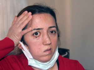 Kafatası kaybolmuştu, şimdi yeni kafatası için yardım kampanyası başlatıldı