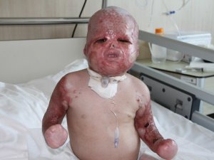 Savaşın acı yüzü Delal bebeğin inanılmaz kurtuluşu