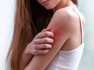 Baharda sık görülen 5 cilt hastalığı