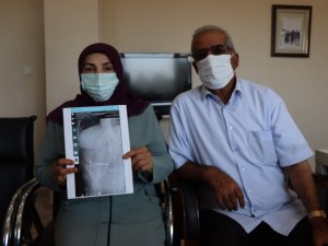 Karnında unutulan makasla 2 ay dolaştı