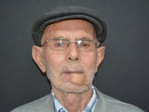 Kol ve bacağından alınan dokularla yeni dudağı oluşturuldu