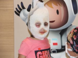 Kaynar suyu üzerine döken çocuk feci şekilde yandı