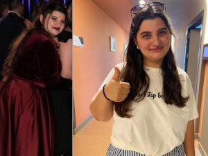 Obezite ameliyatı olmaya Almanya’dan geldi, 10 günde 10 kilo verdi