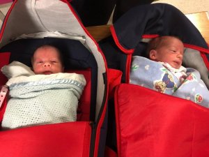 Suriyeli ikizler Türkiye’de şifa buldu