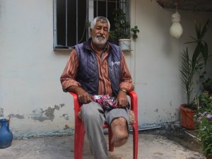 Ayağı kesilen Türk vatandaşına Suriyeli doktordan ücretsiz protez takıldı