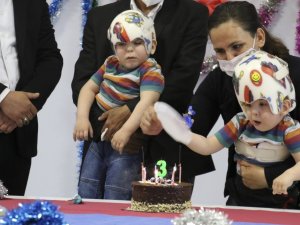 Ameliyatla ayrılan siyam ikizlerine doğum günü sürprizi