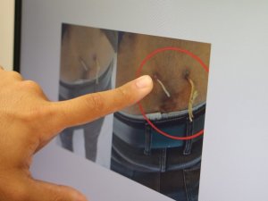 Ağrıları geçsin diye belinden çamaşır ipi geçirmişler