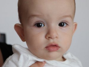 5 binde 1 görülen hastalığa yakalanan bebek erken müdahale ile iyileşti