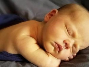 Yenidoğan sarılığı doğru bir şekilde tedavi edilmezse beyin hasarına neden olabilir