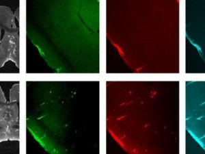 Türk cerrahın Alzheimer’ın şifresini çözecek çalışması saygın tıp dergisinin kapağında
