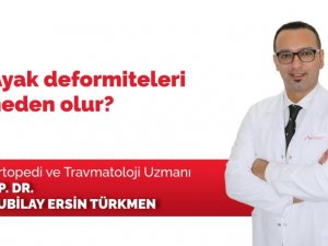 Ayak deformite tedavisinin önemi