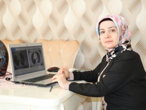 Korona virüs akciğer kanserini taklit etti