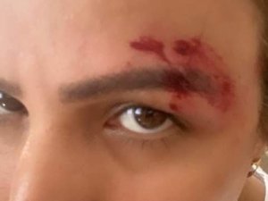 Zafer Parti’li Çelik’in "Suriyeliler saldırdı" yalanı tutmadı