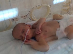 MHP ve AK Parti, doğuştan dudakları yapışık olan Umut bebek için seferber oldu