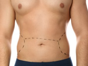 Kusursuz Bir Görüntüye Sahip Olmanız Mümkün!