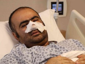 Pitbullun kopardığı buruna estetik yama