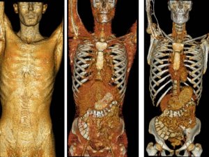 Tıbbın gören gözleri ve görünmeyen emekçilerinin günü