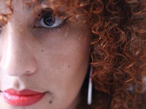 ’’Leke tedavileri uzun solukludur ve sabır gerektirir’’