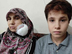 Yüzündeki dev kitleden kurtulmak için yardım bekliyor