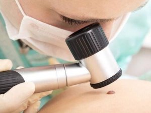 Vücutta hızla yayılıyorsa kanserin habercisi olabilir