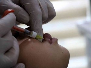 Yanlış uygulanan dudak dolguları körlüğe yol açabiliyor