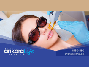 Kıl Problemlerinize Kalıcı Sonuç Lazer Epilasyon