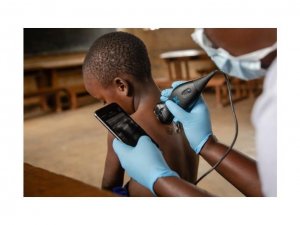 "Teknoloji sağlık hizmetelerini daha ulaşılabir ve eşit hale getiriyor"