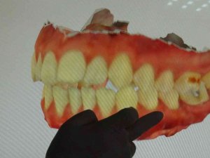 Korona virüs diş ağrılarını arttırdı