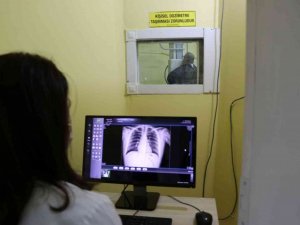 "Tüberküloz tedavi edilebilir bir hastalıktır"