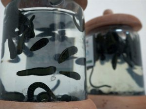 Geleneksel tıbbi yöntemler