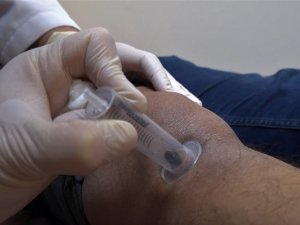 Doktor sülükler şifa kaynağı