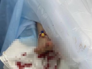 Ukrayna Büyükelçiliği, savaş mağduru ağır yaralı çocuğun fotoğraflarını paylaştı